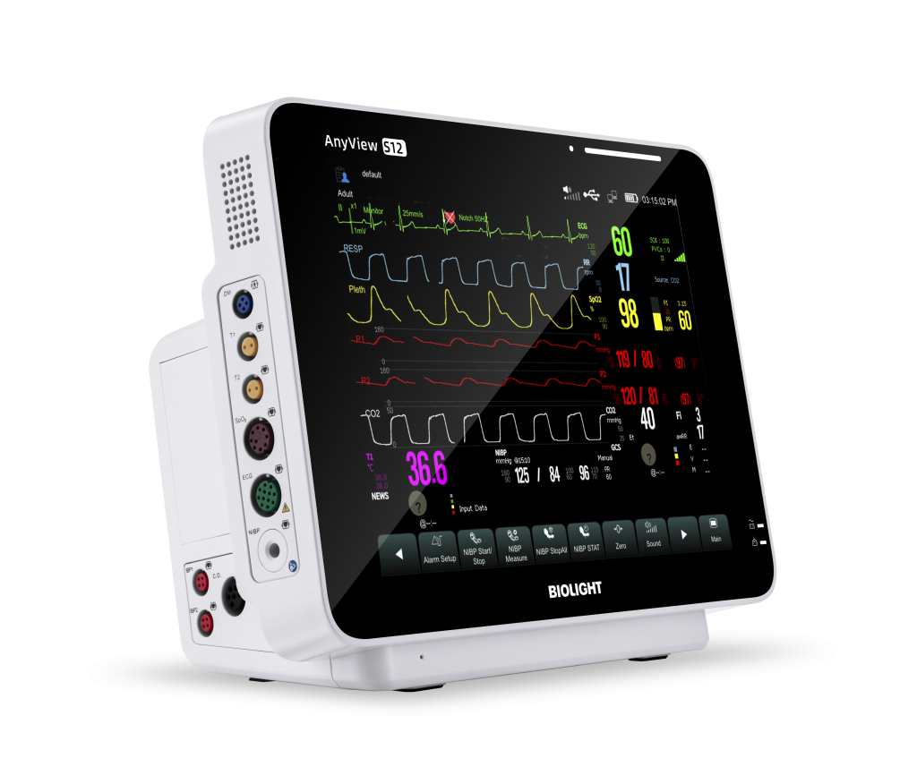 patient monitor